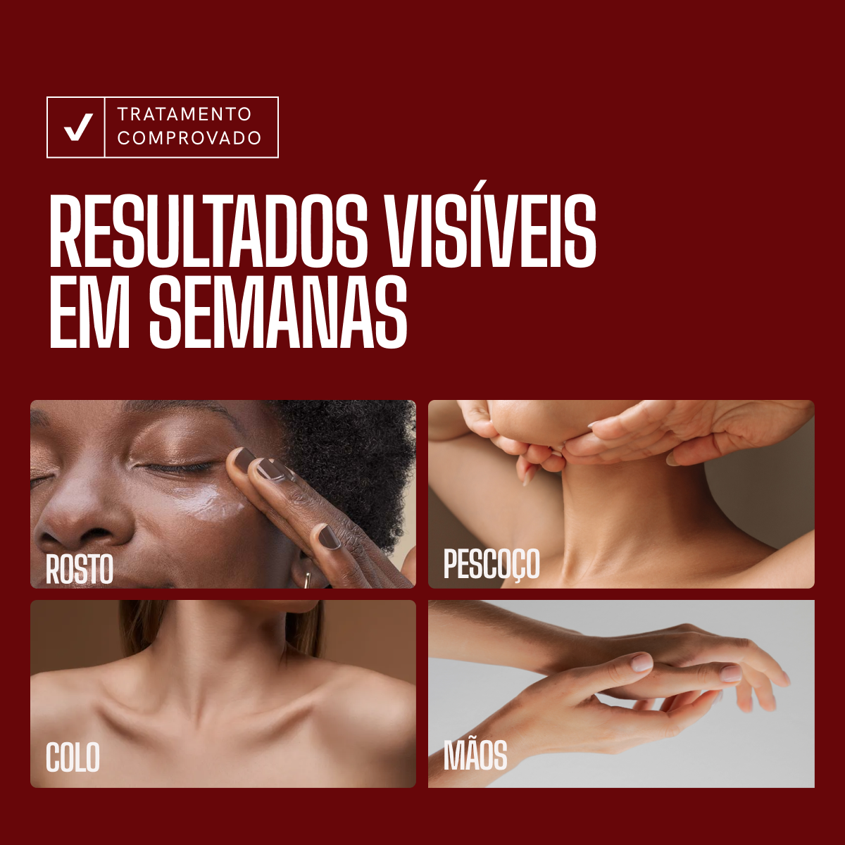 EnvySkin Ácido Tranexâmico
