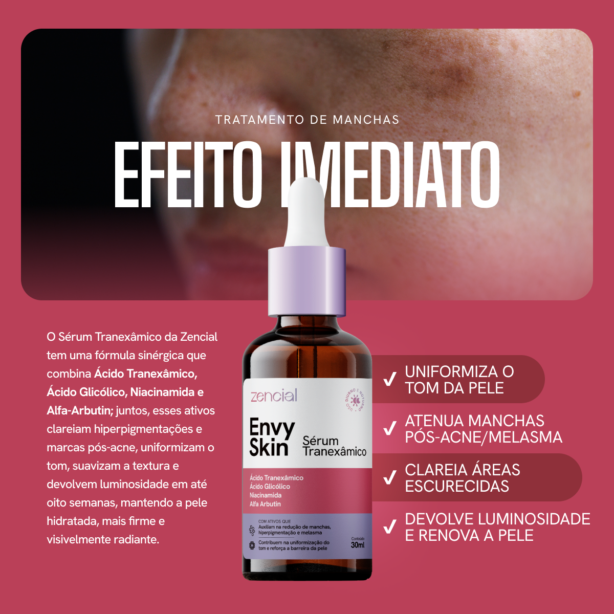 Sérum Clareador Anti-manchas Envy Skin Ácido Tranexâmico