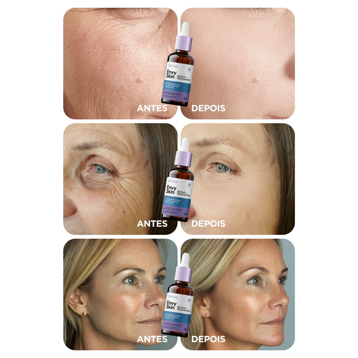 Sérum Anti-Envelhecimento Envy Skin Nano Retinol + Niacinamida 30ml