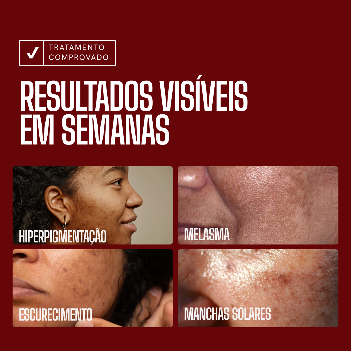 Sérum Clareador Anti-manchas Envy Skin Ácido Tranexâmico