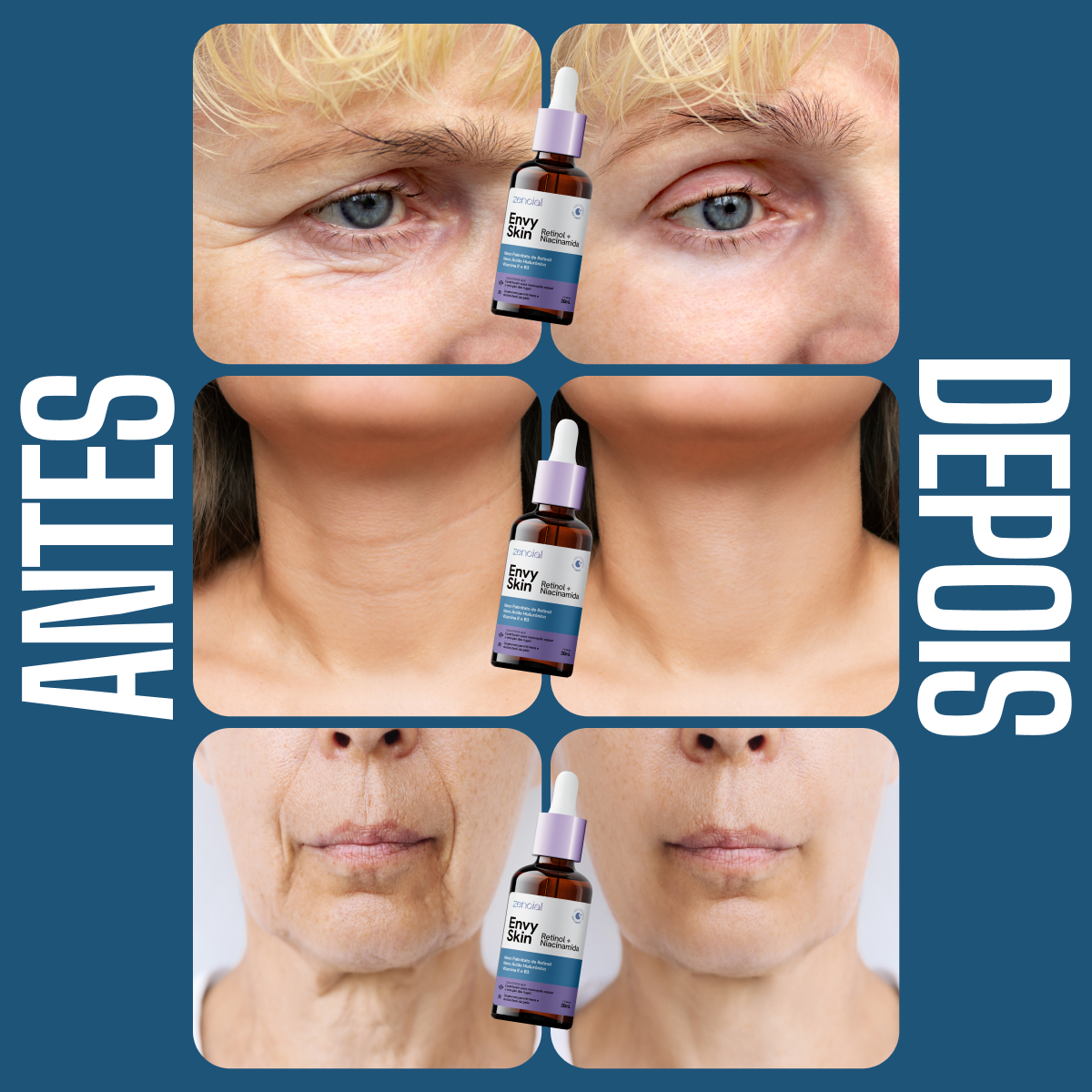 Sérum Anti-Envelhecimento Envy Skin Nano Retinol + Niacinamida 30ml