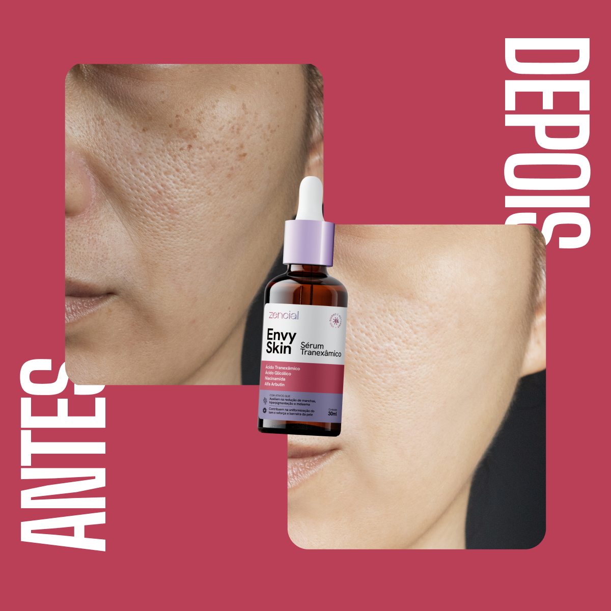 Sérum Clareador Anti-manchas Envy Skin Ácido Tranexâmico