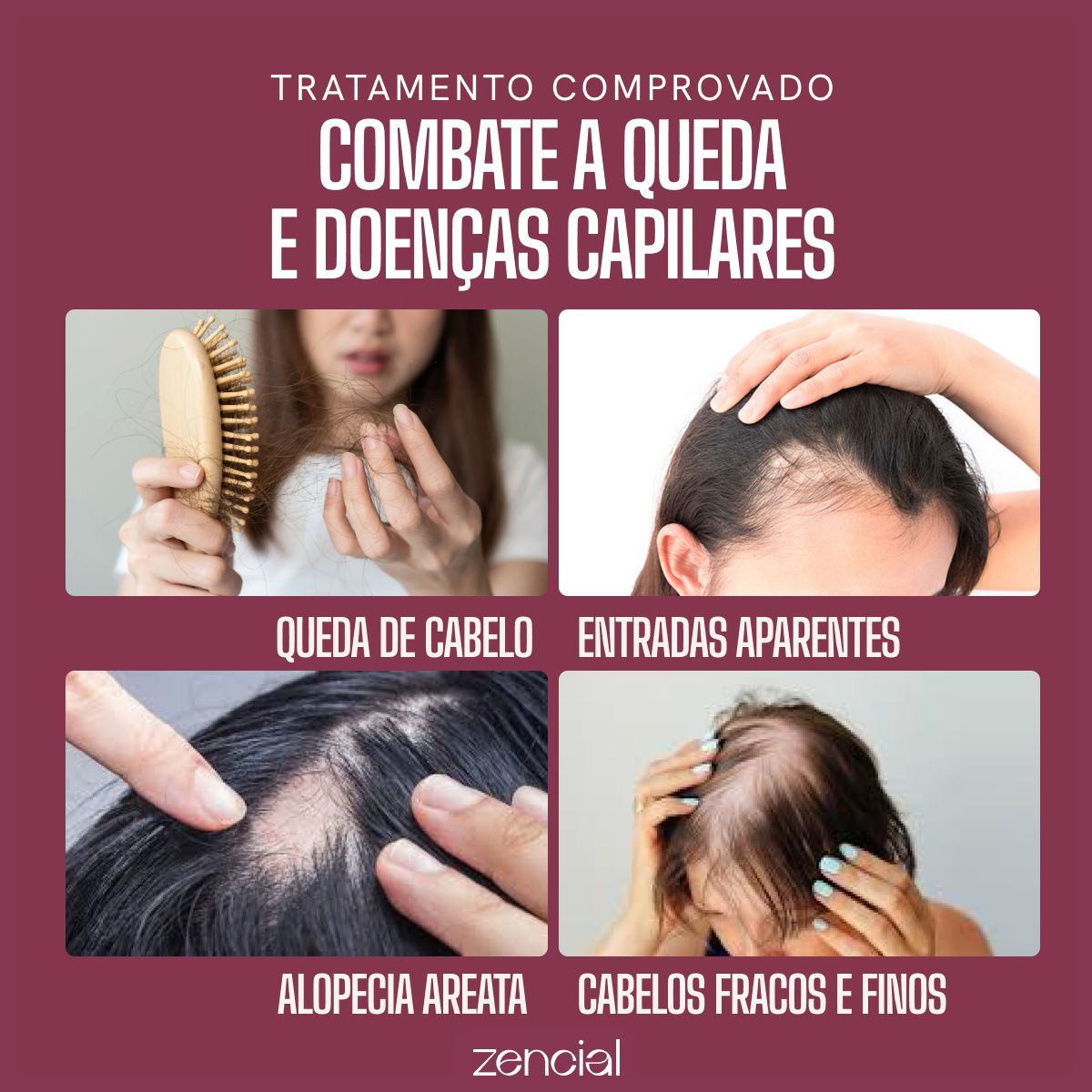 Oléo Capilar Envy Hair Sérum de Crescimento – Zencial